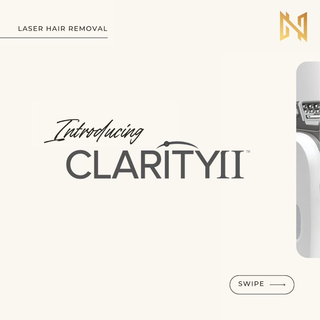 clarity II laser description 1